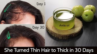 My Mom Turned her Thin Hair to Thick Hair in 30 Days  Amla Hair Oil for Hair Growth amp Long Hair [upl. by Wentworth]