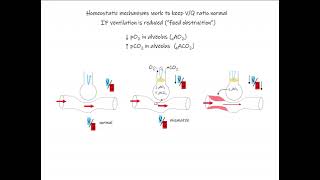 42 Ventilation Perfusion [upl. by Idet]