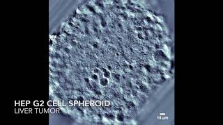 HepG2 Cell Spheroid [upl. by Yztim]