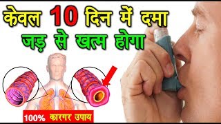 दमा अस्थमा केवल 10 दिन में जड़ से ख़त्म  असरदार नुस्खा  Cure Asthma Permanently in 10 Days [upl. by Ainafets]