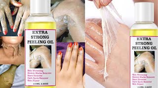 mooyam Yellow Peeling Oil For Dead Skin Removal amp Skin Remove dark spot110ML [upl. by Alejandro]