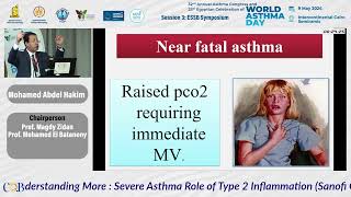 Acute Life Threatening Asthma [upl. by Teodorico]