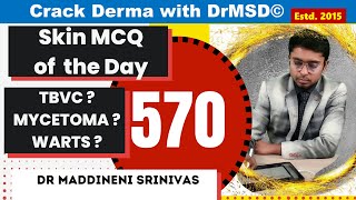 570  TBVC  Cutaneous Tuberculosis  Mycetoma  Verruca vulgaris  Dr Maddineni Srinivas  DrMSD [upl. by Astiram]