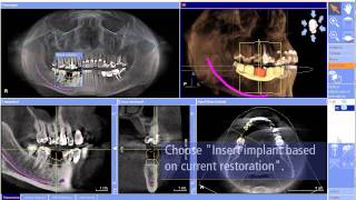 CEREC meet Galileos details en werkwijze bij Henry Schein Nederland [upl. by Adnot]