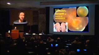 Mayo Clinic Ophthalmology Retina Update and Case Conference Diagnosis of Uveitis  Dr Smith [upl. by Giza]