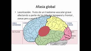 Clasificación de las afasias Clases de neurolingüística [upl. by Aihsetan]