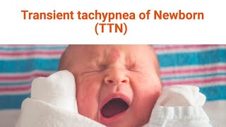 Transient Tachypnea of the Newborn [upl. by Anilorak]