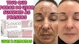 VOU PARAR DE USAR SUAVICID com APENAS 2 SEMANAS de USO  MELASMA VOLTOU “DESMAME PRECOCE” [upl. by Ellemrac39]