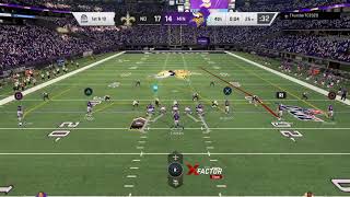 Minneapolis Miracle PT2 [upl. by Sire777]