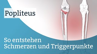 Popliteus Schmerzen Triggerpunkte und deren Aktivierung [upl. by Centeno]