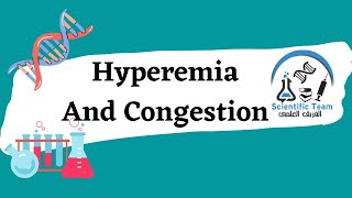 Hyperemia And congestion [upl. by Aydidey]