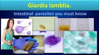 Giardia lambliaLife cycleStructureLabdiagnosisGiardiasisClear overview [upl. by Aidas824]