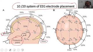 How to practice 1020 EEG electrode placement [upl. by Normandy]