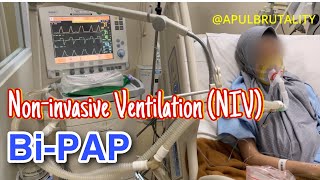 Noninvasive ventilation NIV with bilevel positive airway pressure biPAP [upl. by Ordnael]