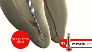 DENTSPLY ProTaper Next [upl. by Refanej]