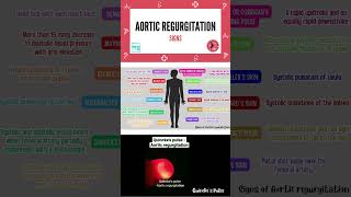 Aortic regurgitation  Shorts  Cardiology  Medi Trix [upl. by Babara]