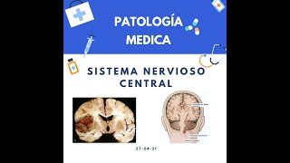 Patología  Sistema Nervioso Central SNC [upl. by Gorrian]