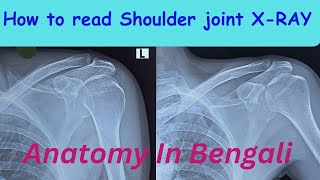 How to read Shoulder joint XRAY Anatomy ll Anatomy in Bengali [upl. by Kenny]