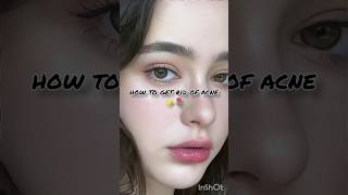 how to get rid acne✨🌷clear skin tips skincare viralvideo shorts [upl. by Towbin572]