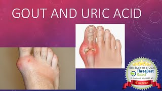 Gout and Hyperuricemia [upl. by Aaren210]