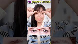 Fix Droopy Eyelids without surgery  Eyelids Lift Exercise [upl. by Hummel653]