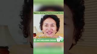 Melasma Cream  40 Off Sale [upl. by Allehcram]