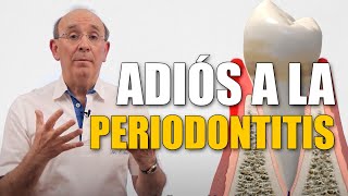 🦷 ¿Qué es la Periodontitis o Piorrea La enfermedad de las encías [upl. by Chemar419]