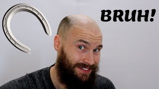 2 YEARS OF BALDING IN 2 MINUTES  Going Bald Fast Horse shoe [upl. by Enimzzaj499]