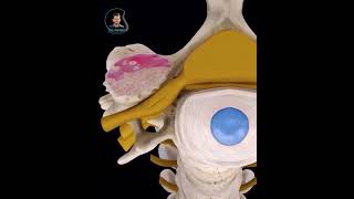 Cervical Foraminal Stenosis [upl. by Qiratla]