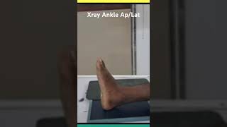 Ankle ApLat positionxraytech youtubeshorts fecebook suscribe [upl. by Assila]