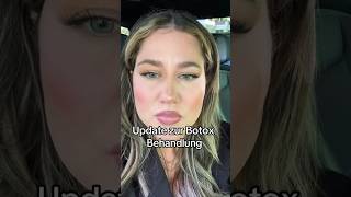 Botox Update beautyaufklärung beautytipps botox zornesfalte [upl. by Dianthe592]