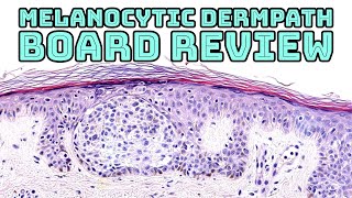 Melanocytic Dermpath Board Review melanoma blue nevus other nevi amp mimics pathology dermatology [upl. by Moishe539]