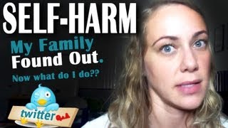 My Family Found Out About My SelfHarm Now What [upl. by Ttihw]