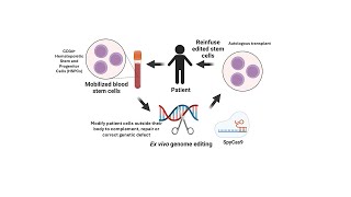 CRISPR geneediting treatment for sickle cell disease explained [upl. by Nibuz]