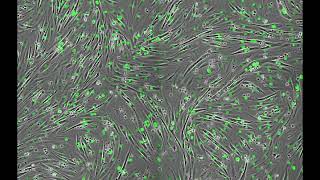 C2C12 cells during differentiation [upl. by Inga924]