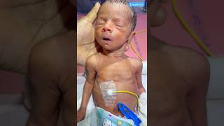 Newborn Hiccups medical viralvideo [upl. by Sousa]