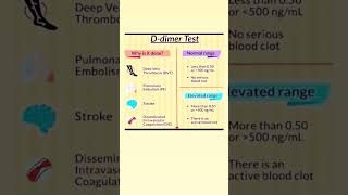 Ddimer Test youtubeshorts neet medicalnursing norcetstudytips [upl. by Swenson64]