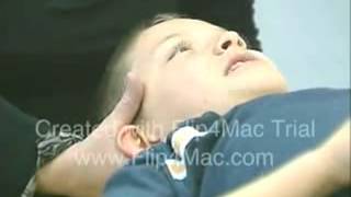 Craniosacral Therapy for TMJ and Autism [upl. by Behlke]