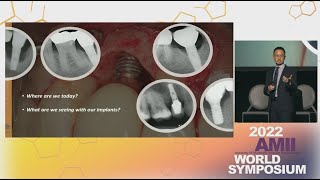 Current state of implantology and the future with MagiCore implant Dr Jeffrey Yang [upl. by Ready464]