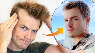 How I Stopped My Receding Hairline Mens Hair Loss Guide [upl. by Amlus]