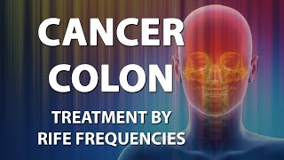 Cancer Colon  RIFE Frequencies Treatment  Energy amp Quantum Medicine with Bioresonance [upl. by Luna]