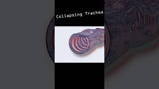 Collapsing Trachea in dogs shorts [upl. by Hafeetal73]