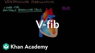 What is ventricle fibrillation Vfib  Circulatory System and Disease  NCLEXRN  Khan Academy [upl. by Elleimac]