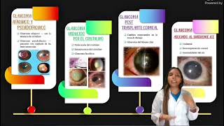 SUBGRUPO 15  GLAUCOMAS SECUNDARIOS Y GLAUCOMA CONGENITO E INFANTIL [upl. by Aimar]