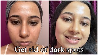 Best Dermatologist recommended Skincare Routine to remove Dark Spots Hyperpigmentation Acne Marks [upl. by Pooley]