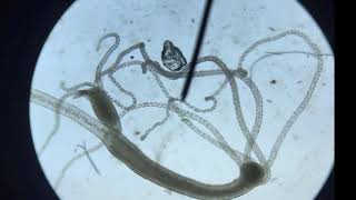 Brown hydra microscope footage [upl. by Sessler]