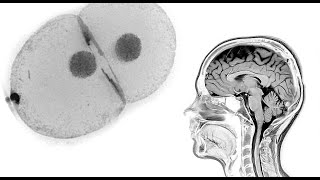 MITOSIS MENTAL  Visualizer  VORTEX  PEDRO PRODUCTIONS [upl. by Gilead]