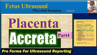 Fetus Ultrasound Placenta Accreta Part4 [upl. by Durst]