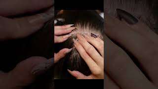 ASMR Intense Scalp SCRATCHING and NITPICKING with Nails Real Person shorts short asmr [upl. by Fawne]