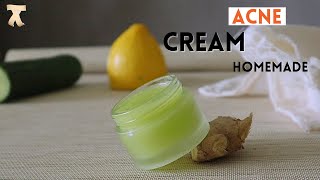 Homemade pimple cream  100 effective acne treatment [upl. by Atinas416]